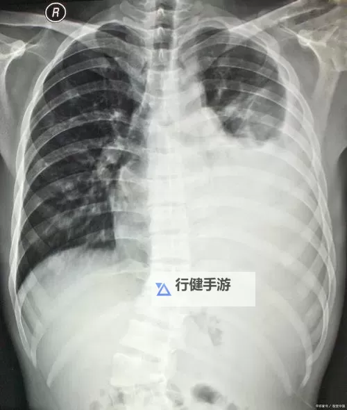 我想看胸片曝光2024今日更新:最新动态一览图1