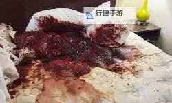 自杀二十天：生命的倒计时与希望的曙光